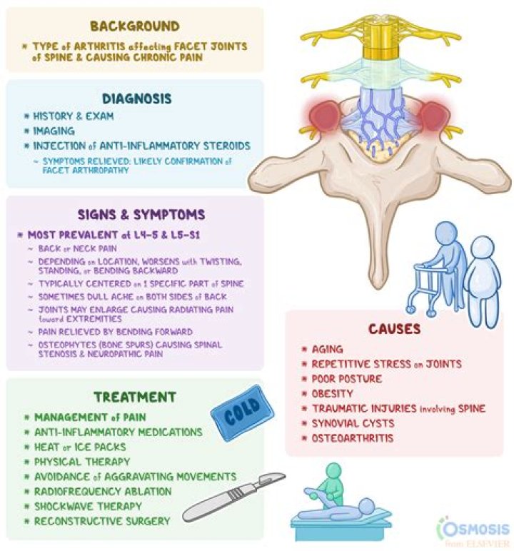 A Comprehensive Guide To Facet Hypertrophy: Definition And Causes