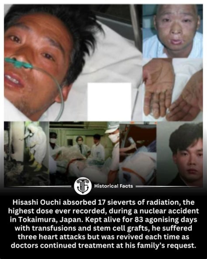 A Comprehensive Guide To Hisashi Ouchi Hospital: Medical Excellence And Care
