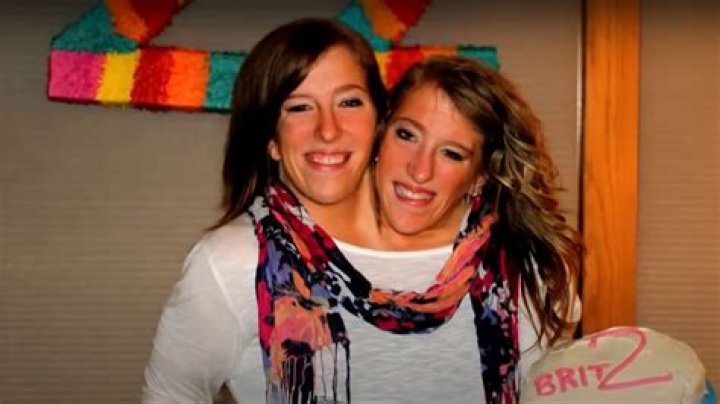 Abby And Brittany Hensel: Their Inspiring Story And Heartbreaking End