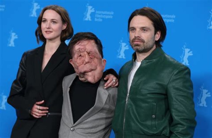 Adam Pearson's Wife: A Voice For Disability Advocacy And Representation