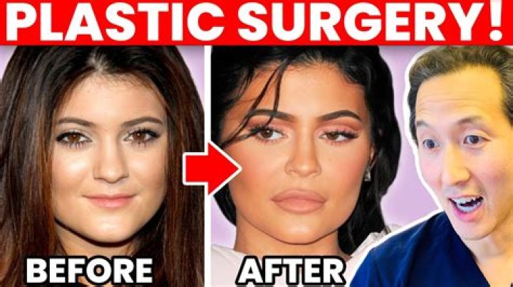 Aishah Sofey: A Journey Through Plastic Surgery And Self-Transformation