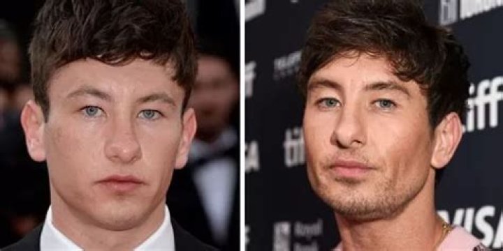 Barry Keoghan: Plastic Surgery Transformations And Their Effects