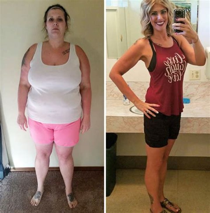 Before & After Plenity Weight Loss Pictures