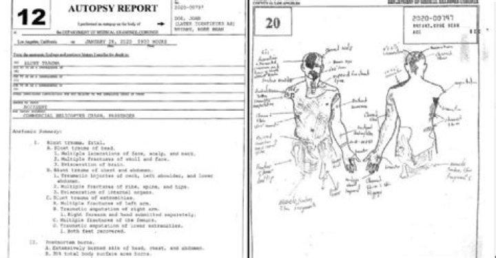 Chilling Autopsy Details: Unveiling The Tragic Demise Of Gianna Bryant