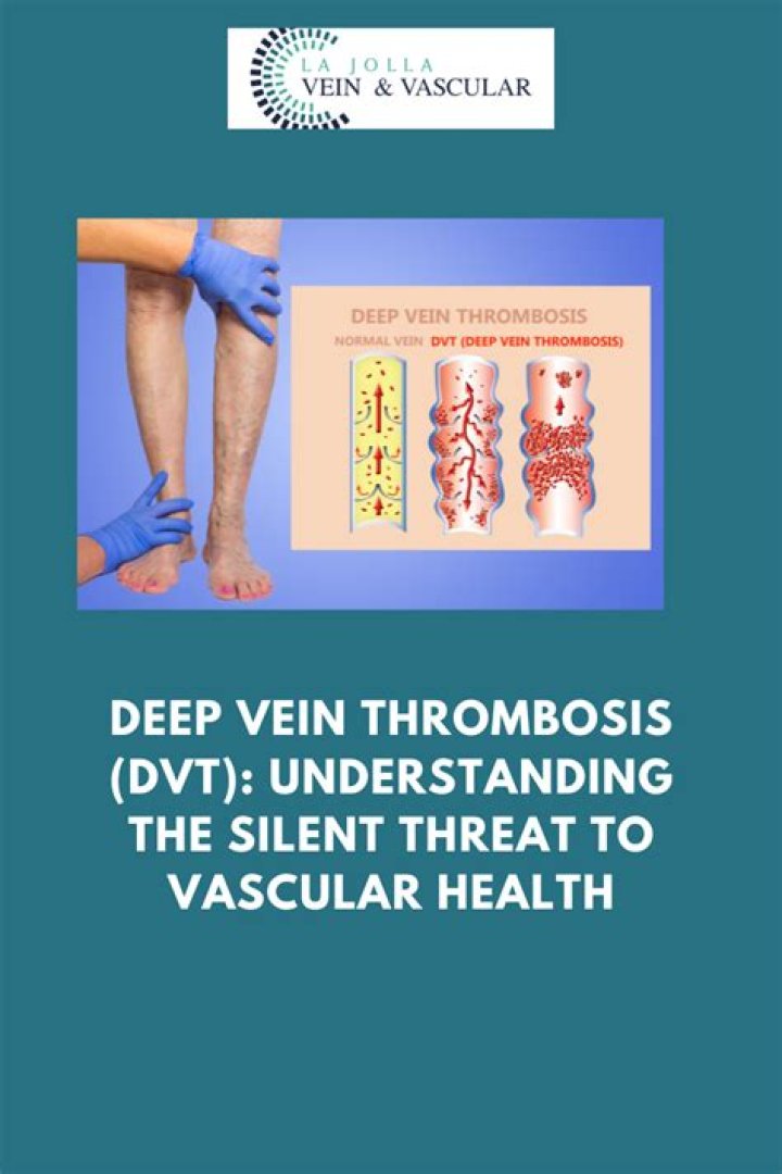 Comprehensive Guide To Deep Vein Thrombosis ICD-10 Codes: Identify And Understand