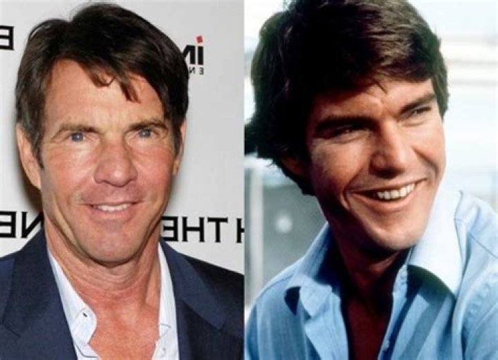 Dennis Quaid's Plastic Surgery: Enhancing His Youthful Appearance