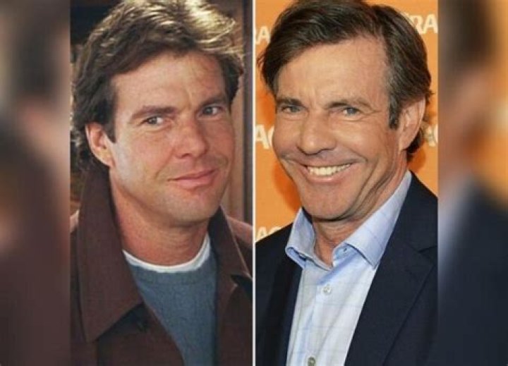 Dennis Quaid Surgery: Actor Undergoes Procedure For Back Pain