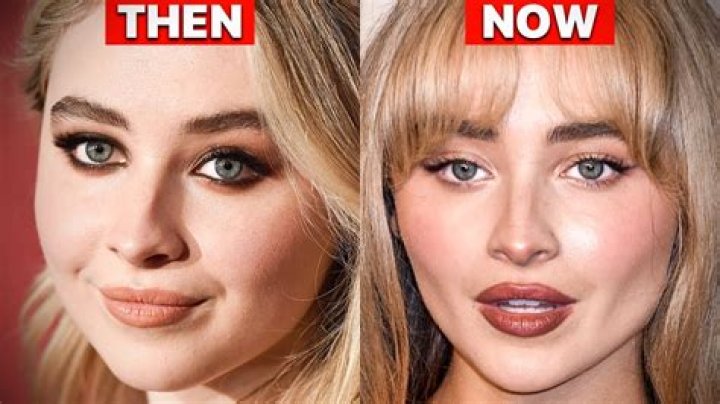 Did Sabrina Carpenter Get Plastic Surgery? The Truth Revealed