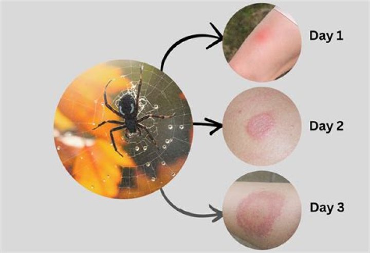 Discover The Secrets: Unveiling Signs Of Spider Pregnancy