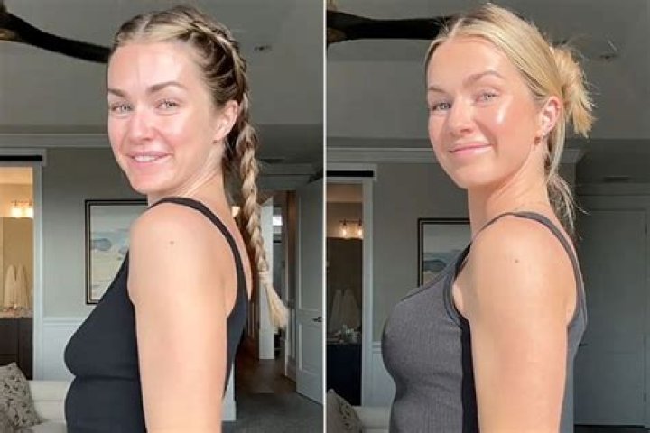 Does Alex Hall's Transformation Include Breast Augmentation?