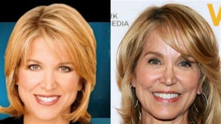 Dr. Mireya Mayor - Exceptional Face Surgery: Transform Your Appearance