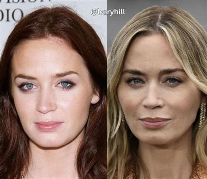 Emily Blunt's Hearing Status Revealed