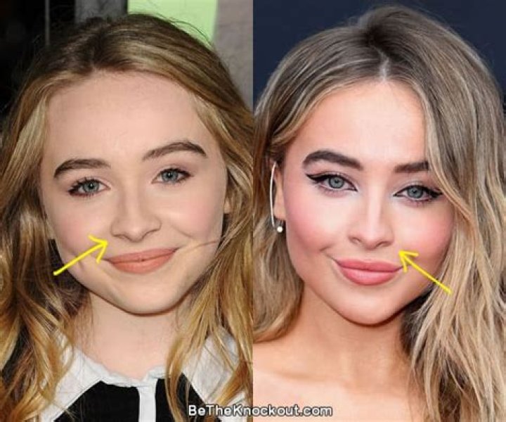 Exploring Sabrina Carpenter Before Fillers