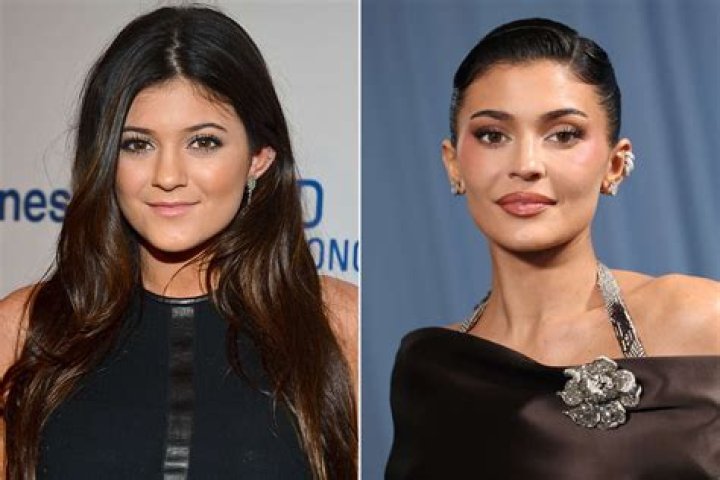 Exploring The Truth: Has Kylie Jenner Lost Weight?