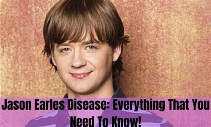 Getting To Know Jason Earles