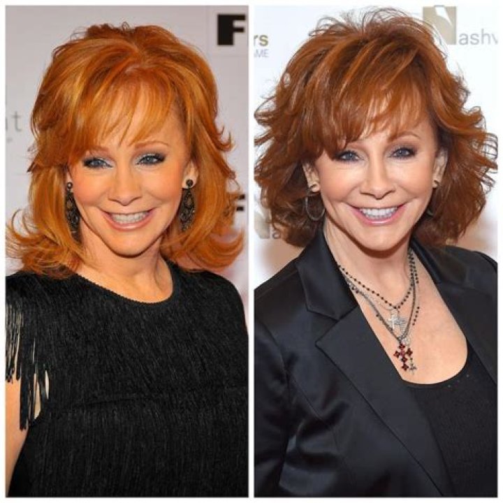 Has Reba McEntire Undergone Cosmetic Surgery? The Truth Revealed