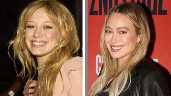 Hilary Duff had her teeth shortened ·