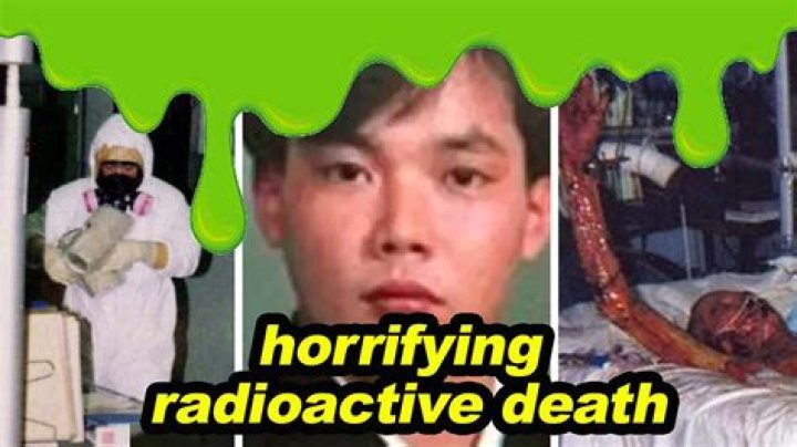 Hisashi Ouchi: A Haunting Reminder Of The Horrors Of Radiation