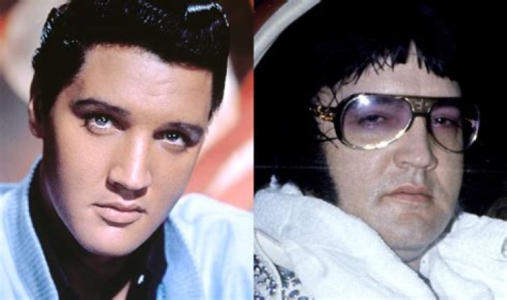 How Did Elvis Presley Die? Uncovering The Tragic End