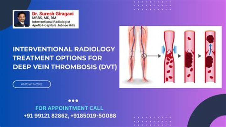 ICD-10 Code For Ruling Out Deep Vein Thrombosis (DVT) In The Lower Extremity