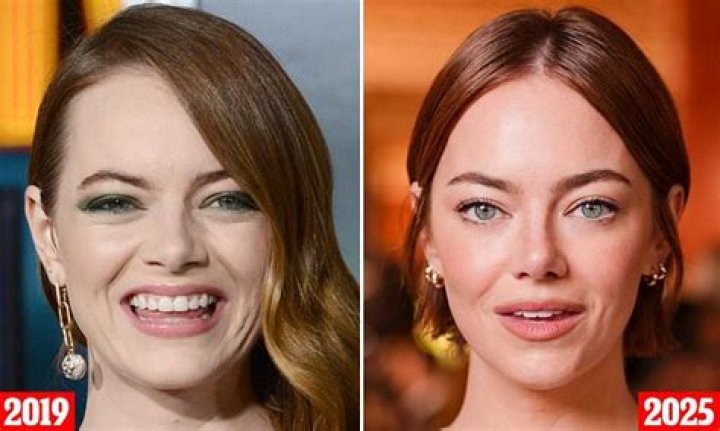 Introducing Emma Stone's Adorable New Baby