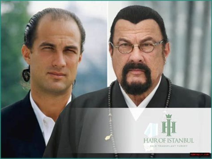 Is Steven Seagal Still Alive? Unraveling The Truth