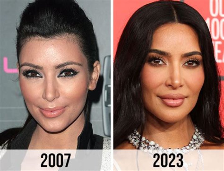Kim Kardashian's Plastic Surgery Journey: Before And After Transformation
