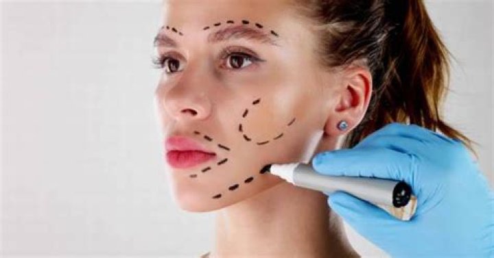 Kimberly Guilfoyle's Cosmetic Surgery: A Detailed Guide