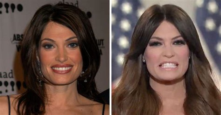Kimberly Guilfoyle's Dramatic Facial Transformation: Unmasking The Details