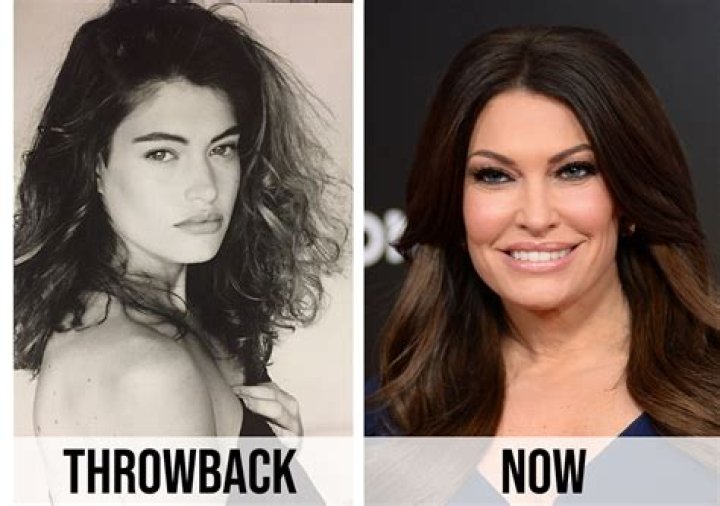Kimberly Guilfoyle's Stunning Transformation: Before And After