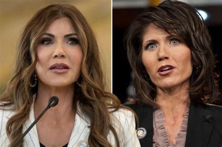Kristi Noem Before And After Plastic Surgery