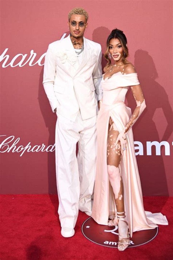 Kyle Kuzma's Girlfriend's Skin Condition: A Closer Look