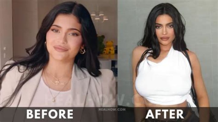 Kylie Jenner's Weight Gain Sparks Public Curiosity