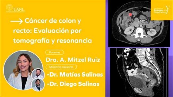 La Luz contra Colón en vivo hoy La Luz - Colon resultados al minuto 27.07.2024