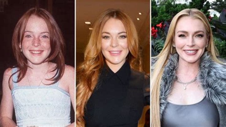 Lindsay Lohan's Journey With Plastic Surgery