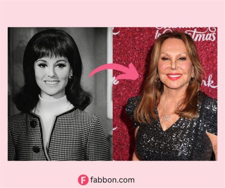 Marlo Thomas Nose: Revealing The Truth Behind The Speculations