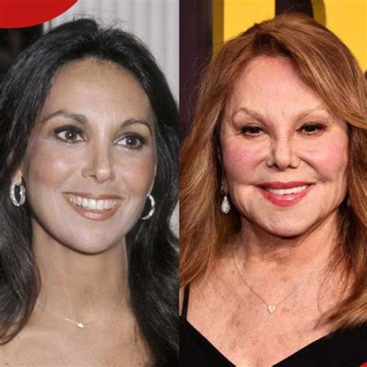 Marlo Thomas Plastic Surgery Before And After Transformation