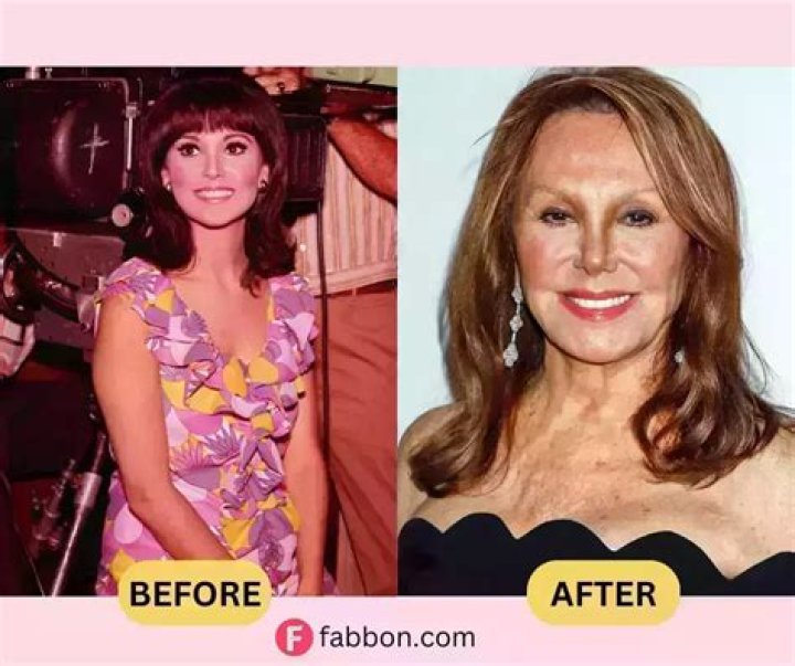 Marlo Thomas: The Secrets Of Her Ageless Face