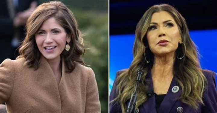 Meet Kristi Noem's Skilled Plastic Surgeon