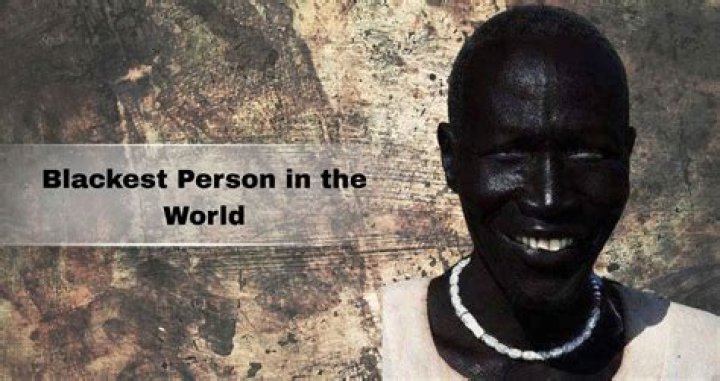 Meet The Blackest Person On Earth