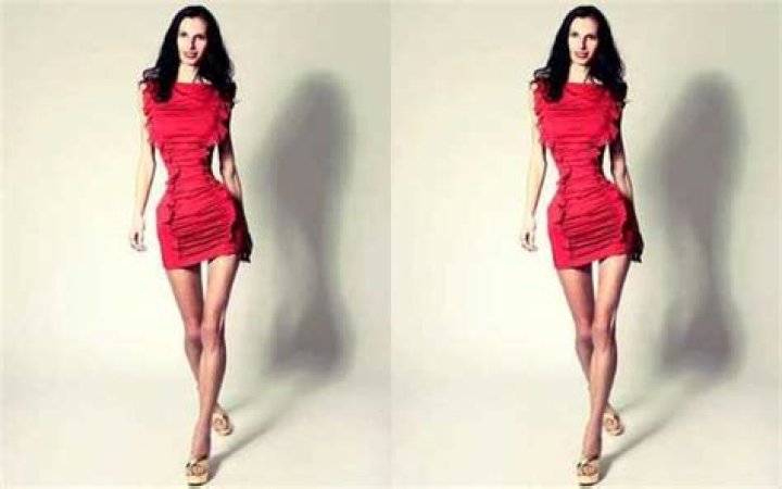 Meet The Remarkable 'World's Skinniest Lady'