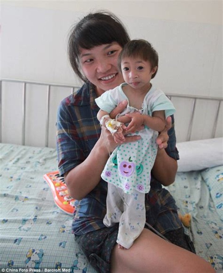 Meet The World's Tiniest Girl: An Extraordinary Tale Of Resilience