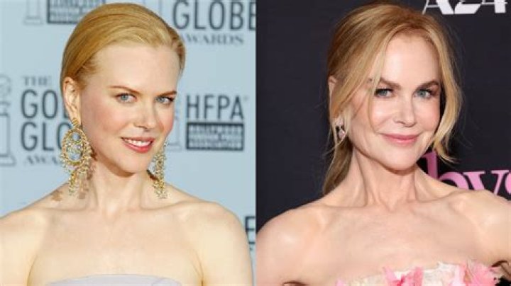 Nicole Kidman's Plastic Surgery Transformation: A Before-and-After Comparison