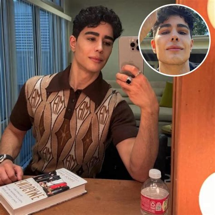 Omid Scobie's Transformation Before Plastic Surgery