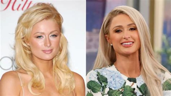 Paris Hilton's Plastic Surgeries: A Look Into Her Transformations