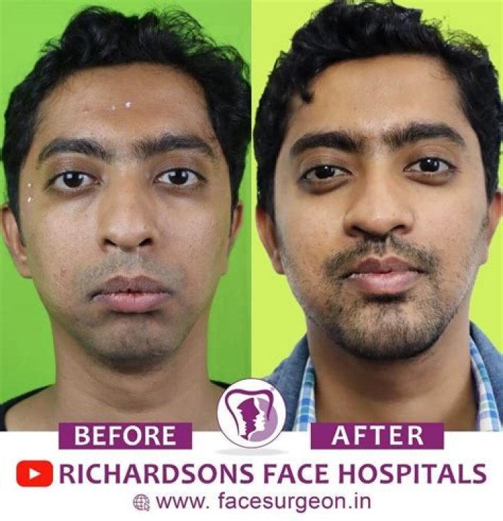 Randy Adams' Shocking Facial Transformation After Devastating Accident