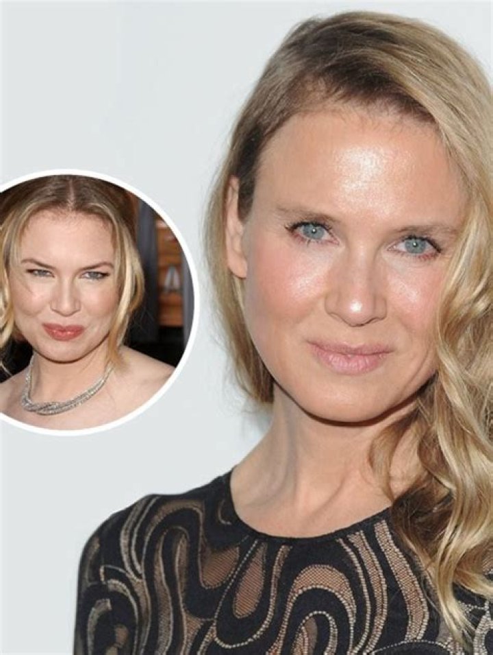 Renee Zellweger Now And Then