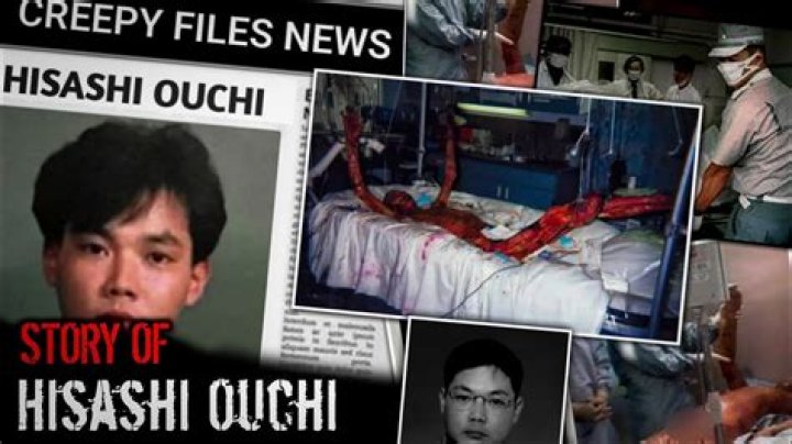 Revealed: The Unseen Real Photos Of Hisashi Ouchi