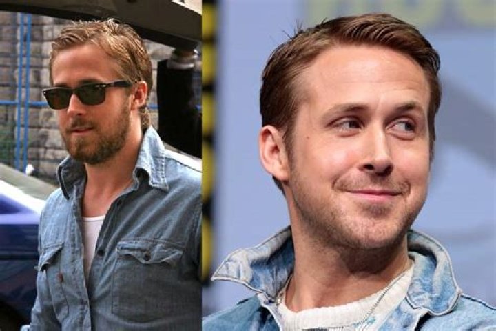 Ryan Gosling's Plastic Surgery Journey