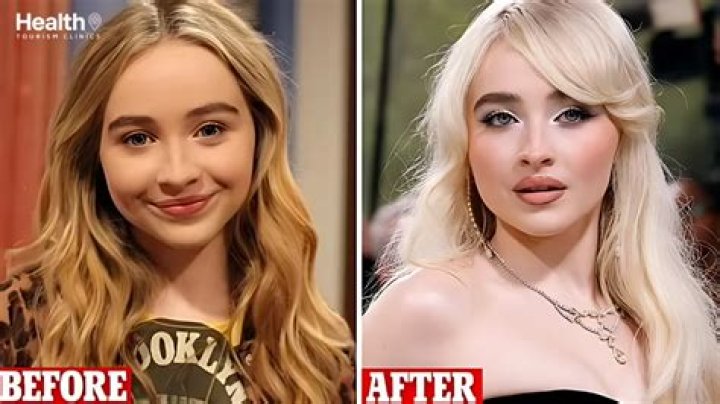 Sabrina Carpenter's Plastic Surgery Journey: Before And After